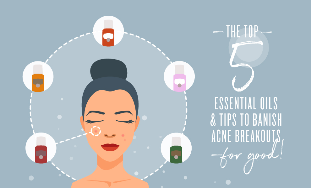 essential oils for acne featured image