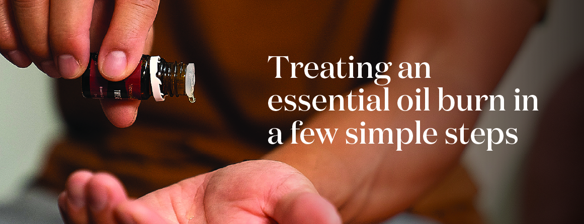 How to treat an essential oil burn - Young Living Lavender Life Blog